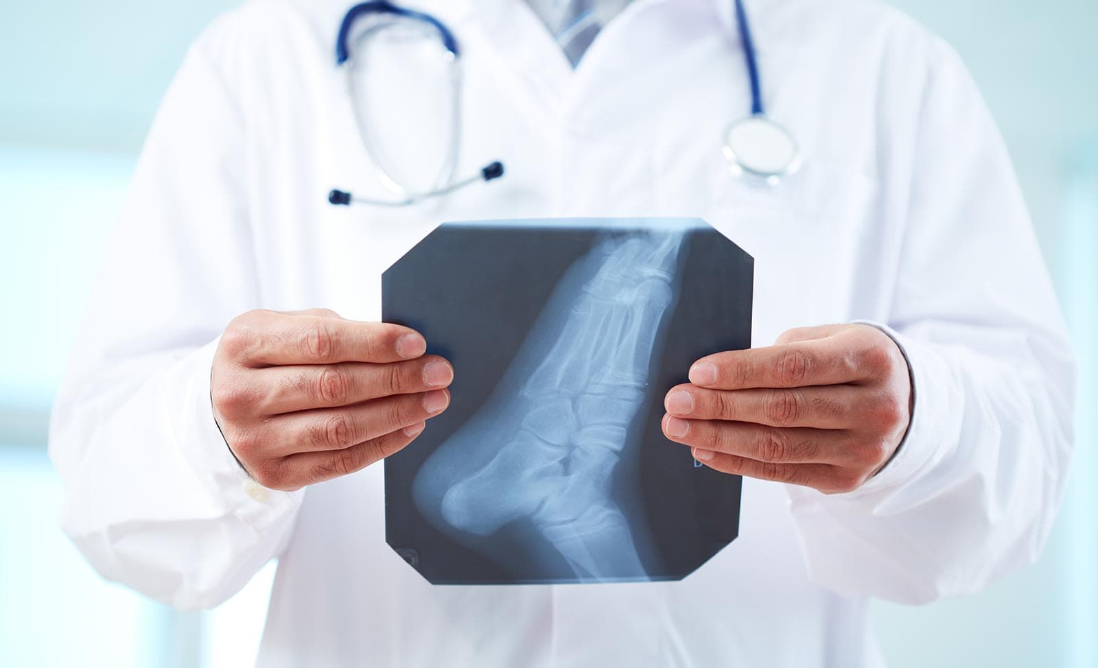 foot xray foot xray